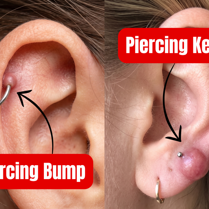 Image showing the difference between piercing bump and keloid. 