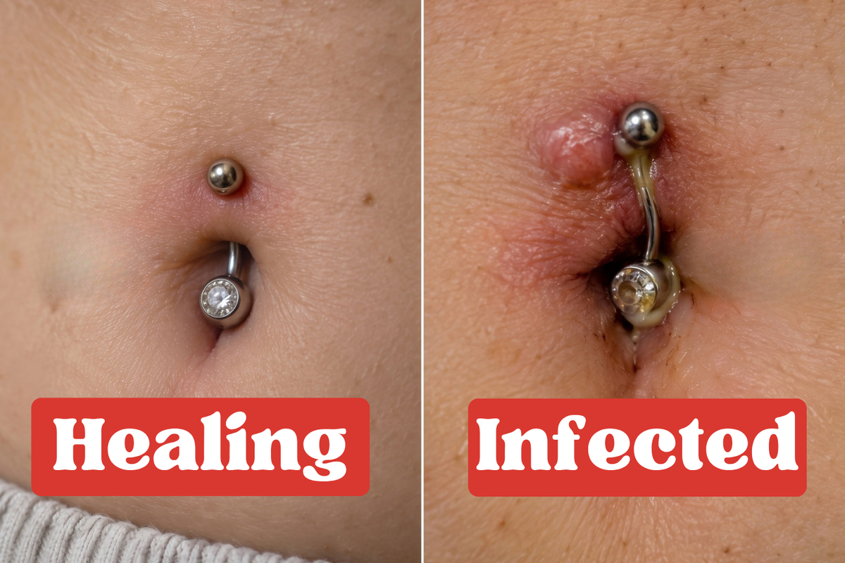side by side comparison of an infected belly piercing and normal belly piercing healing